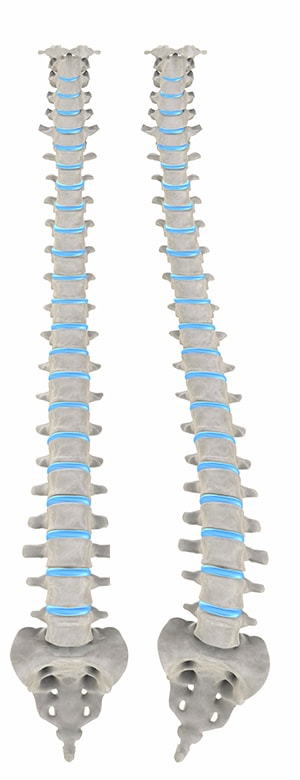 What You Need To Know About Scoliosis